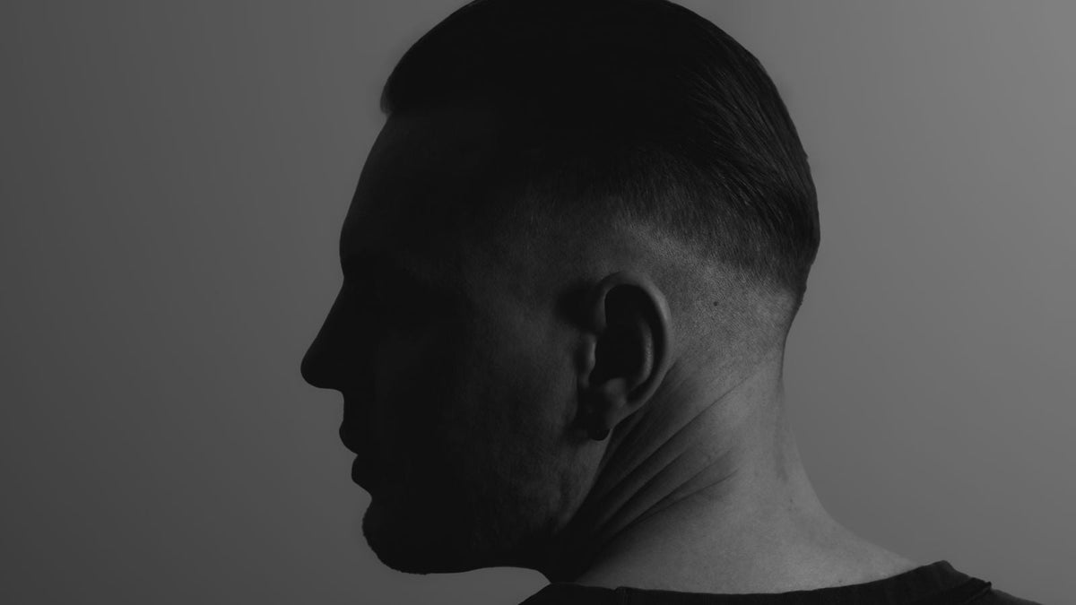 Back of a man's head with short hair, the donor area used in follicular unit extraction