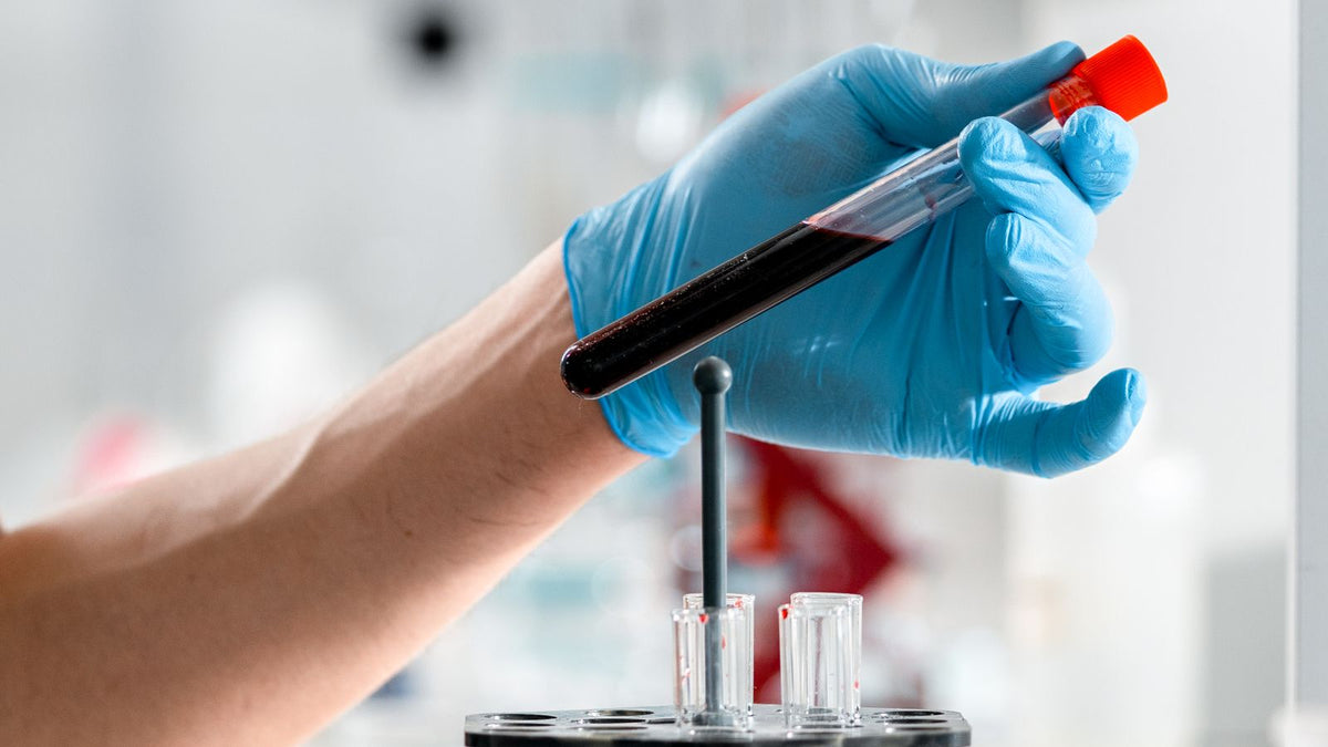Gloved hand holding a blood sample tube used to work out a free androgen index