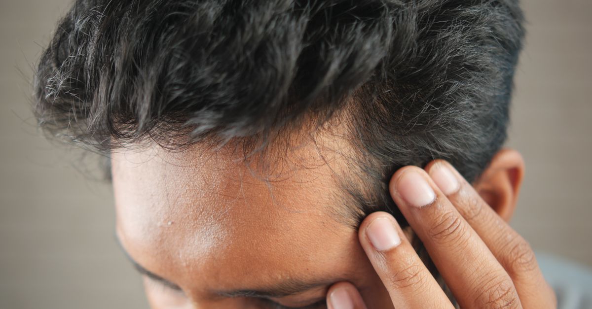 Man touching the top of his head in contemplation, weighing up realistic hair growth expectations