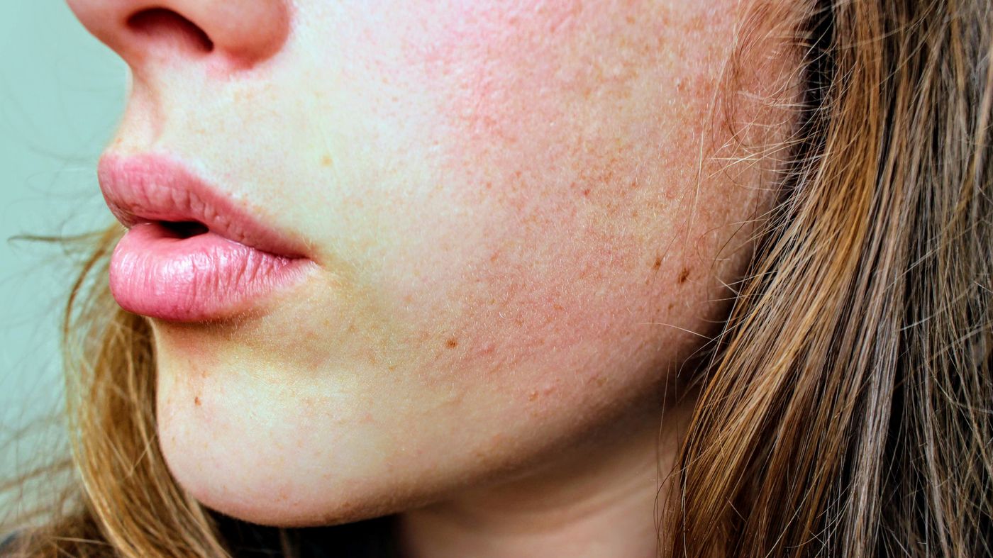 Close up of natural facial skin texture, the starting point for how to know your skin type