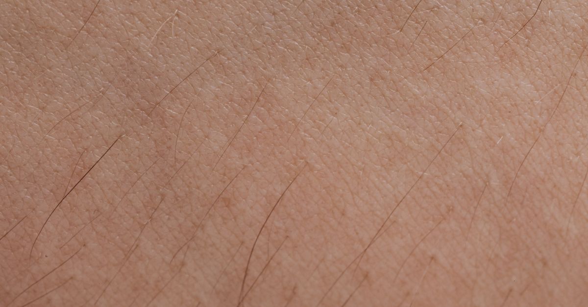 Close-up of scalp skin and hair follicles, the structures people hope to reactivate