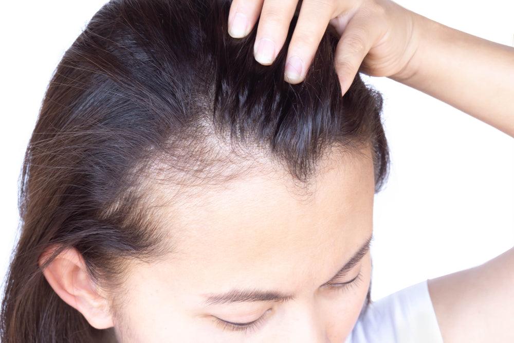 Regrow Thinning Hair and Boost Confidence with These Tips - Watermans