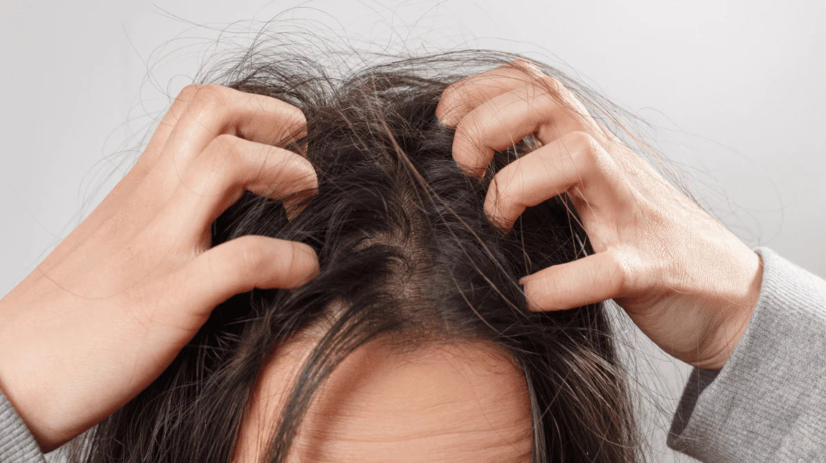 Seborrheic Dermatitis: How to Treat a Flaky Scalp - Watermans