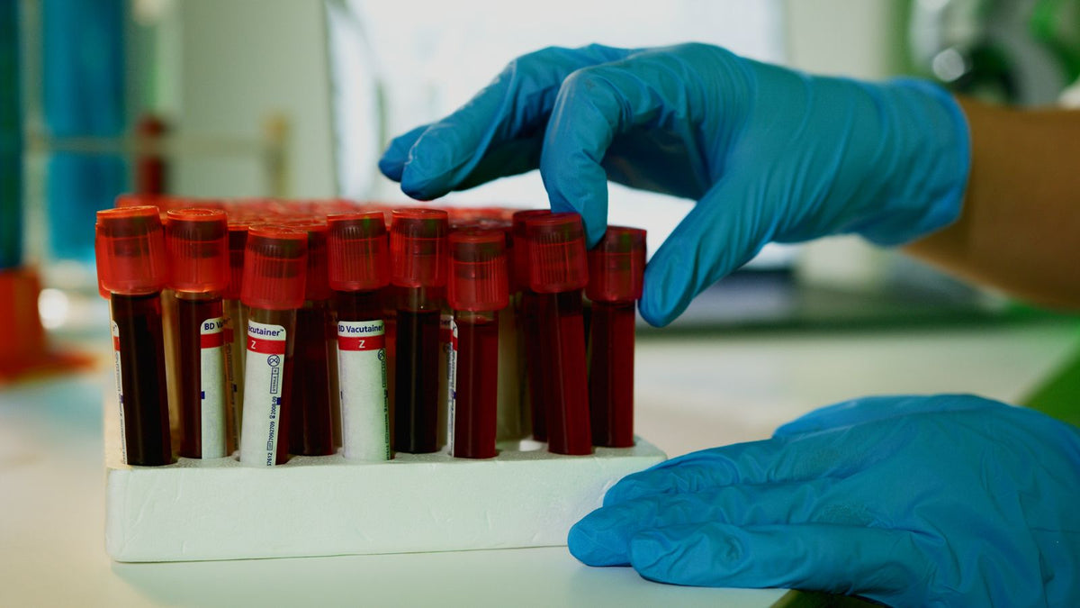 Lab technician handling blood vials, the kind of sample used to measure total testosterone