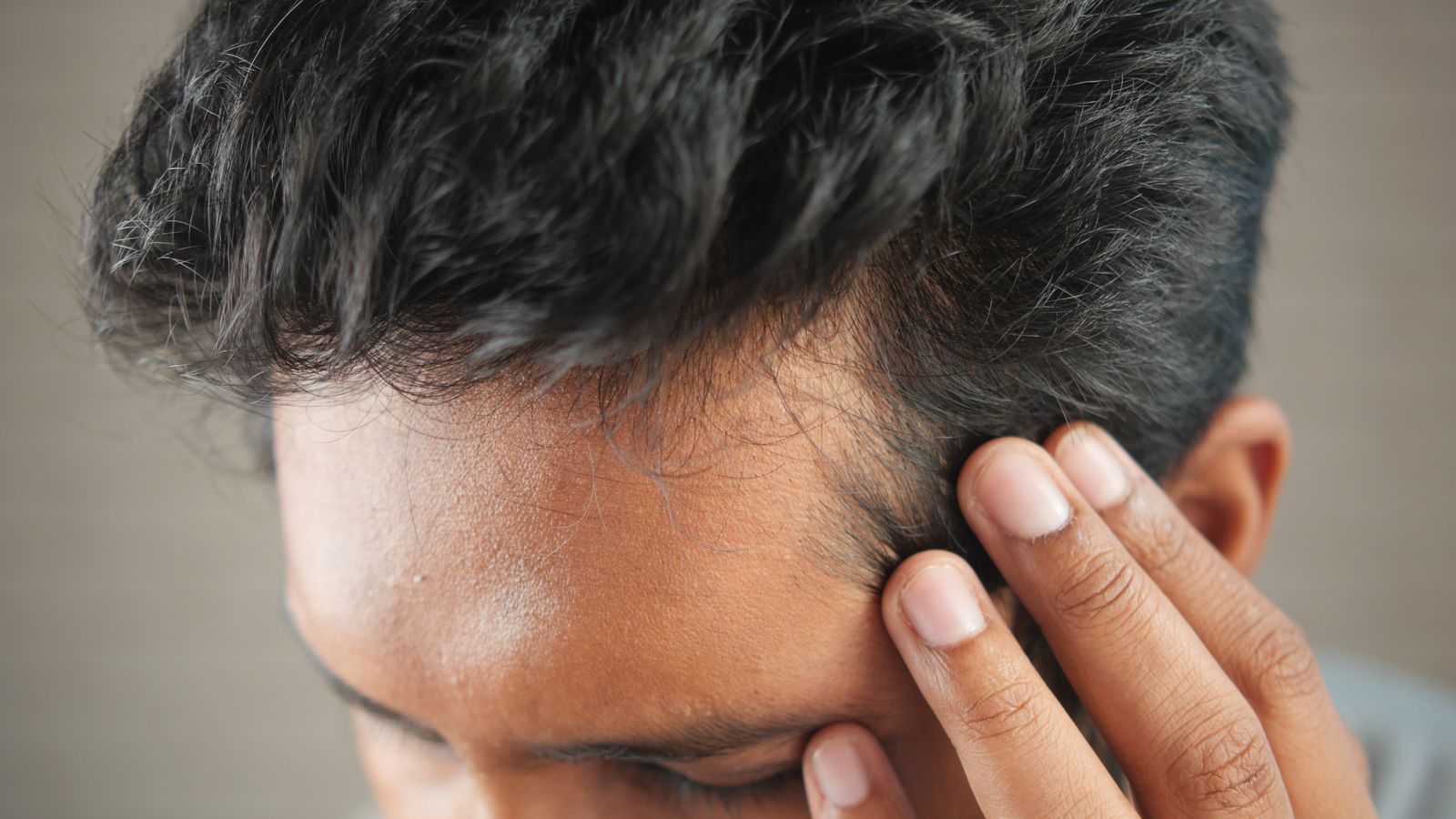 Man resting a hand on his head after finding a bald patch, the moment many people first look for a trichologist in Halifax