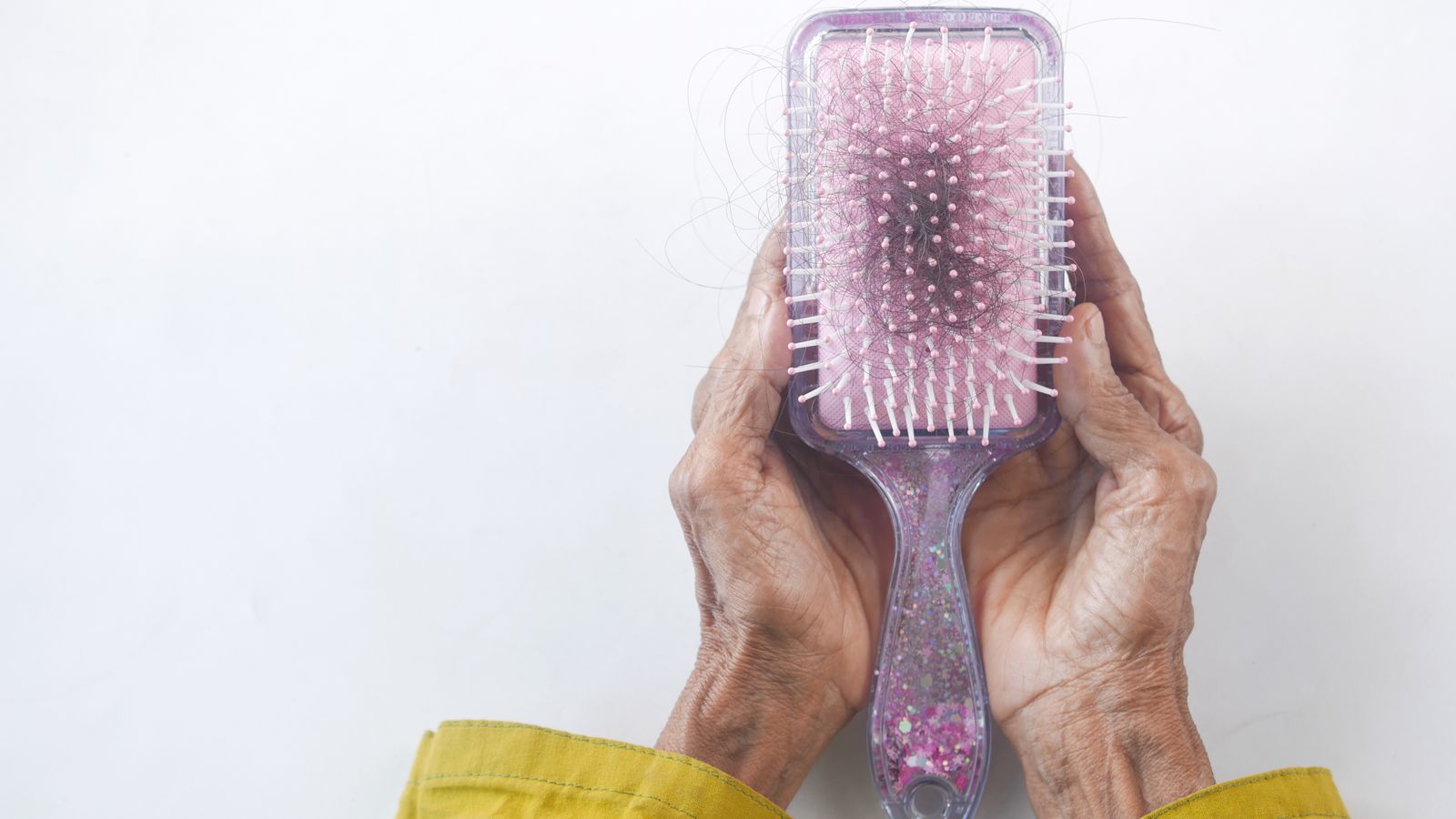 Hairbrush with shed hair, the everyday sign of what causes telogen effluvium