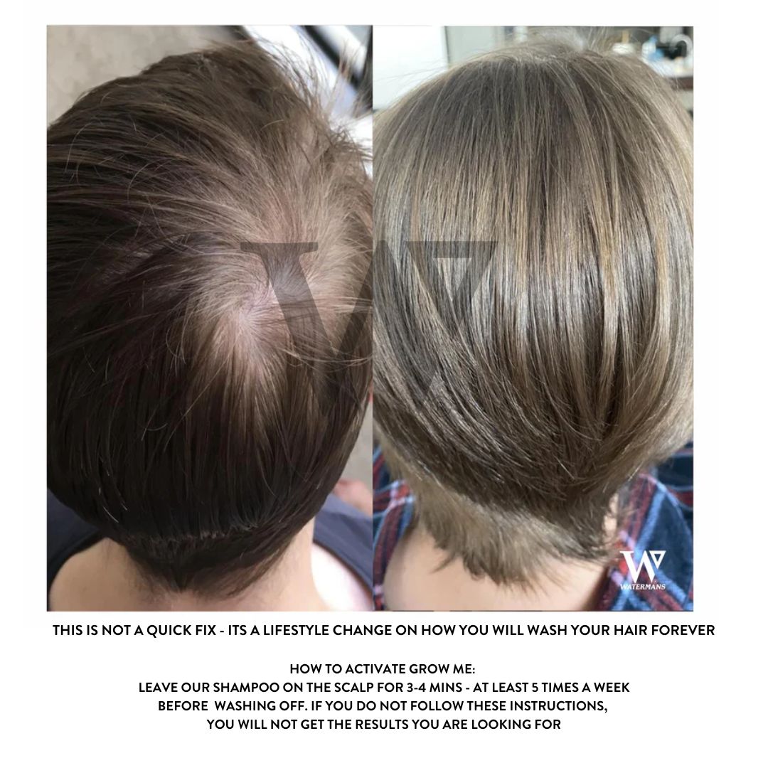 Grow Me Shampoo - DHT Blocker - SAVE MY HAIR