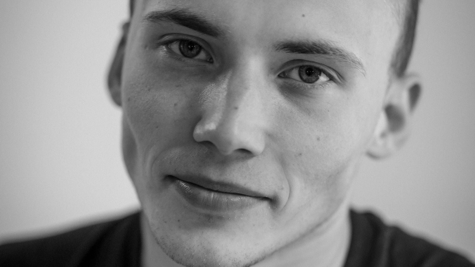 Portrait of a balding man, what triggers androgenic alopecia