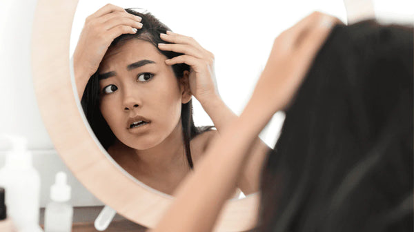 Can Stress Cause Hair Loss? - Watermans