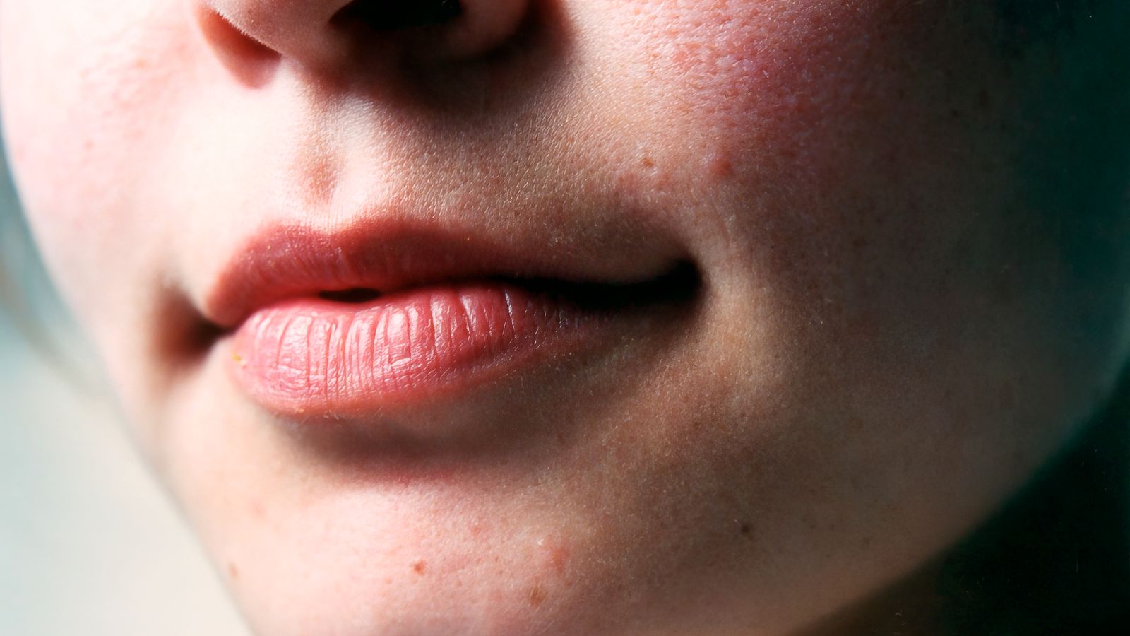 Close up of lips and natural skin texture, illustrating what chapped lips look like