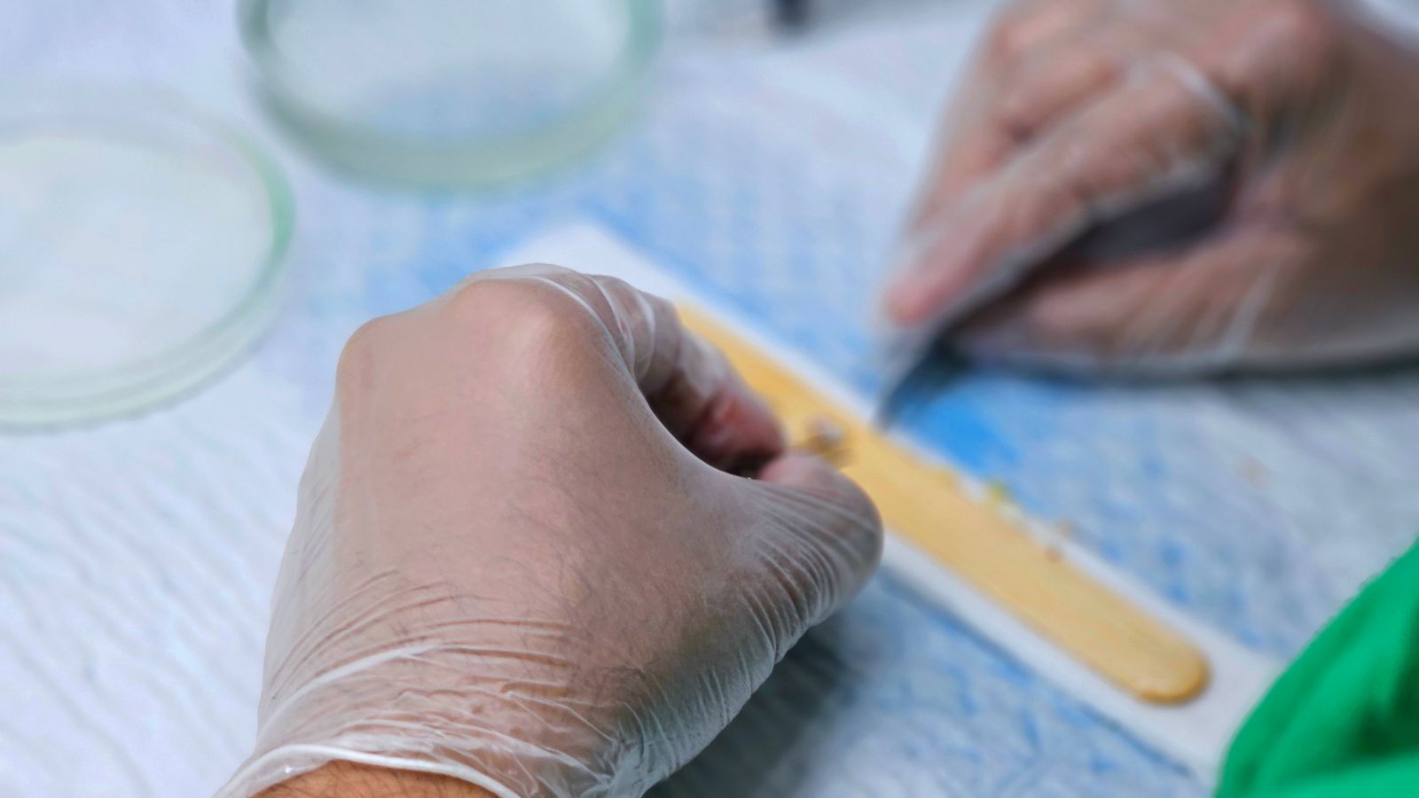 Hair graft preparation during a hair transplant procedure
