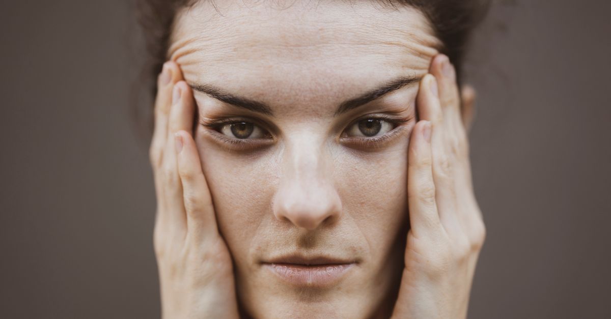 Close-up portrait of a woman's face and forehead, the starting point for how to lower hairline