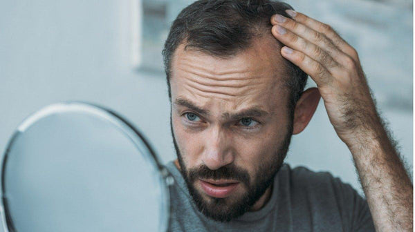How To Prevent Hair Loss - Watermans