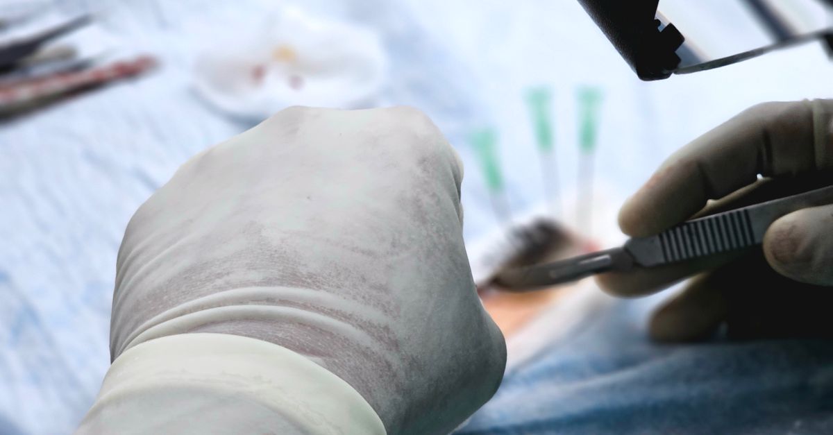 A hair transplant procedure in a clinic, comparing DHI and FUE