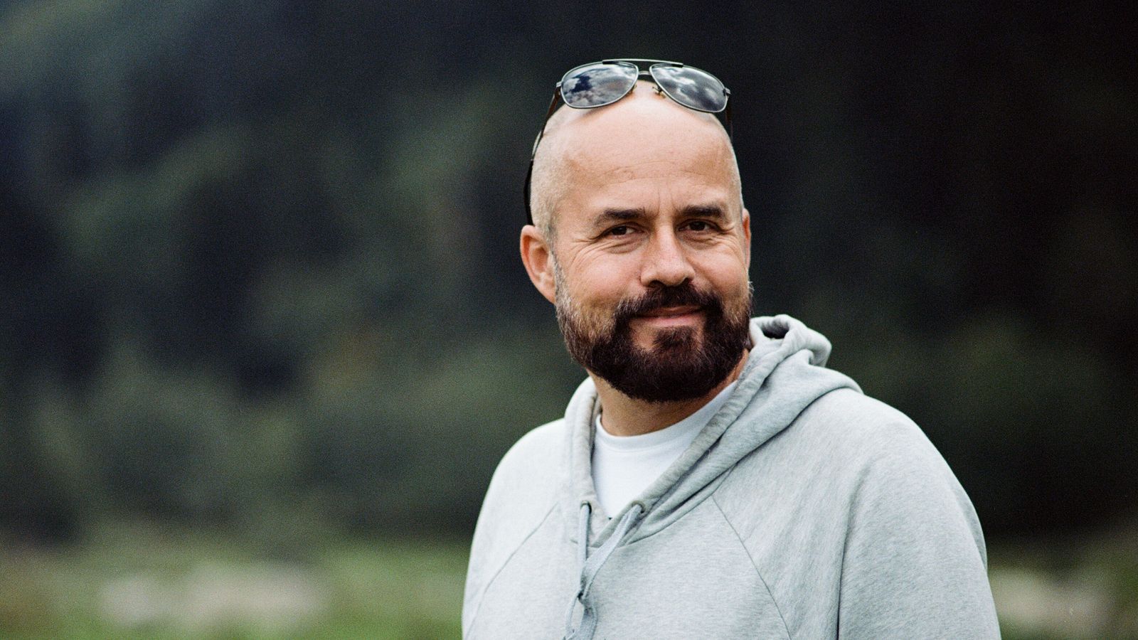 Confident smiling man, self-acceptance with alopecia hair loss
