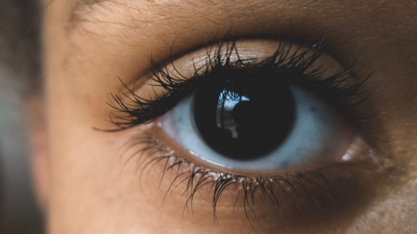 Close up of an eye with sparse lashes, illustrating why eyelashes fall out