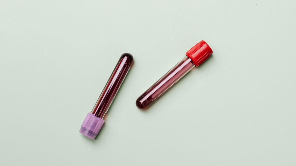 Blood sample tubes on a light background, the samples used to produce liver function test results