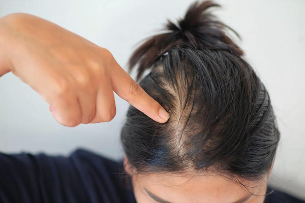 Prevent Hair Loss and Promote Healthy Growth with These Expert Tips - Watermans