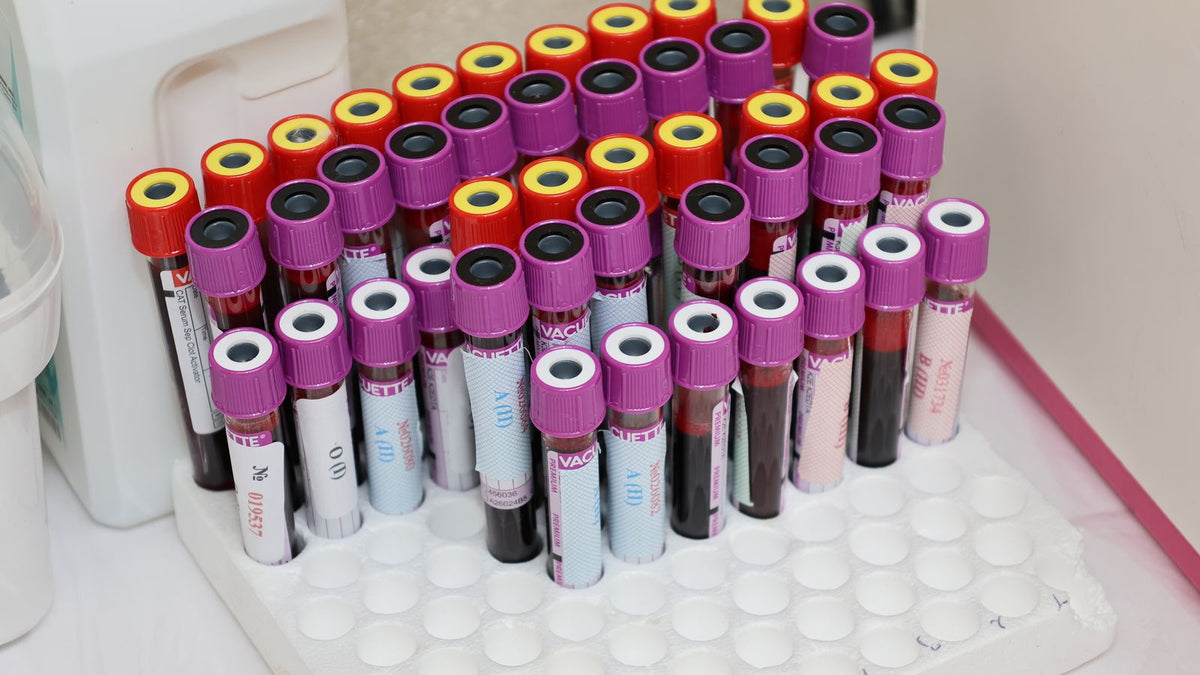 Rows of blood sample vials in a laboratory, including SHBG testing