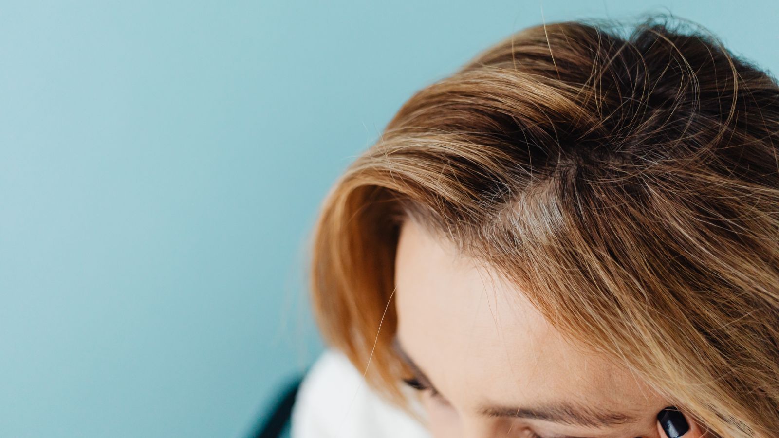 Close up of a woman's forehead and hairline showing temple hair thinning