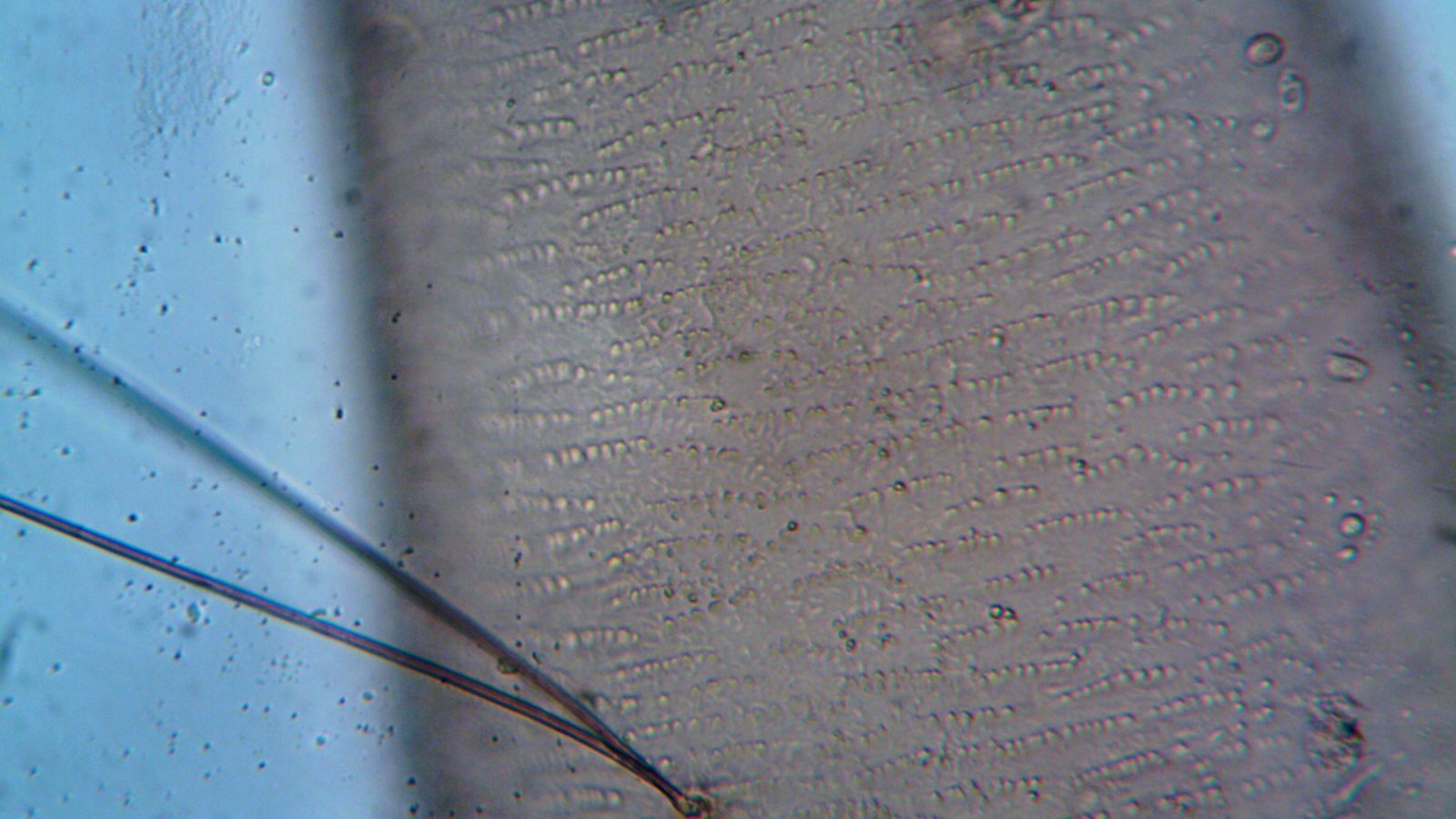 Hair follicle viewed under a microscope, the basis of a trichogram