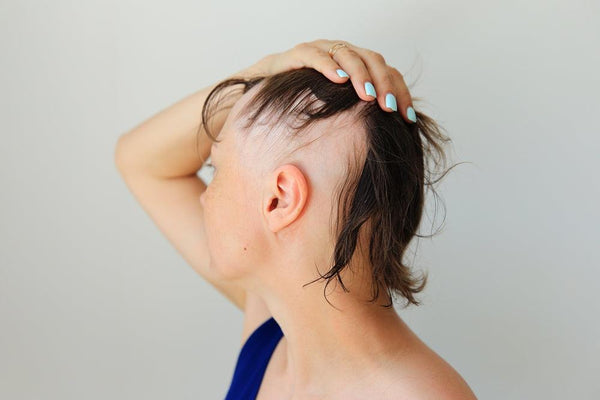 What triggers androgenic alopecia? - Watermans