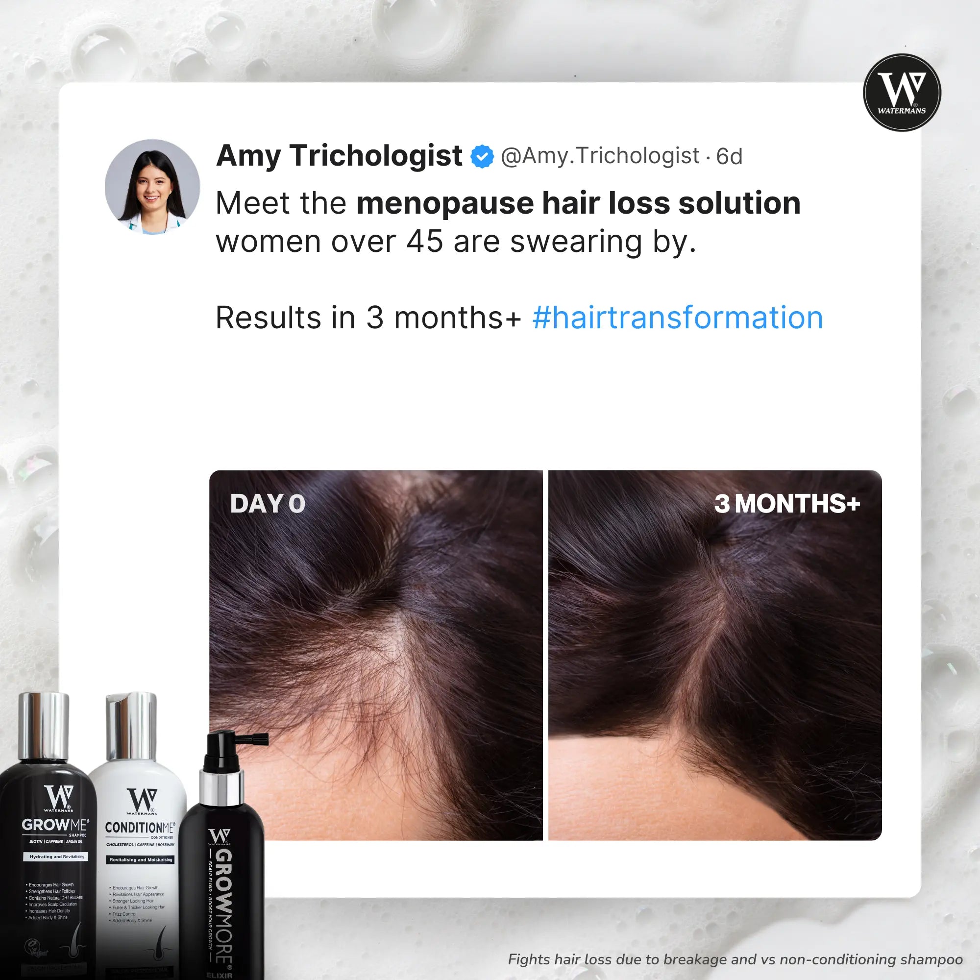 Shampoo & Conditioner, Elixir leave-in scalp treatment.  Hair Survival Kit - 🔥 MOST POPULAR