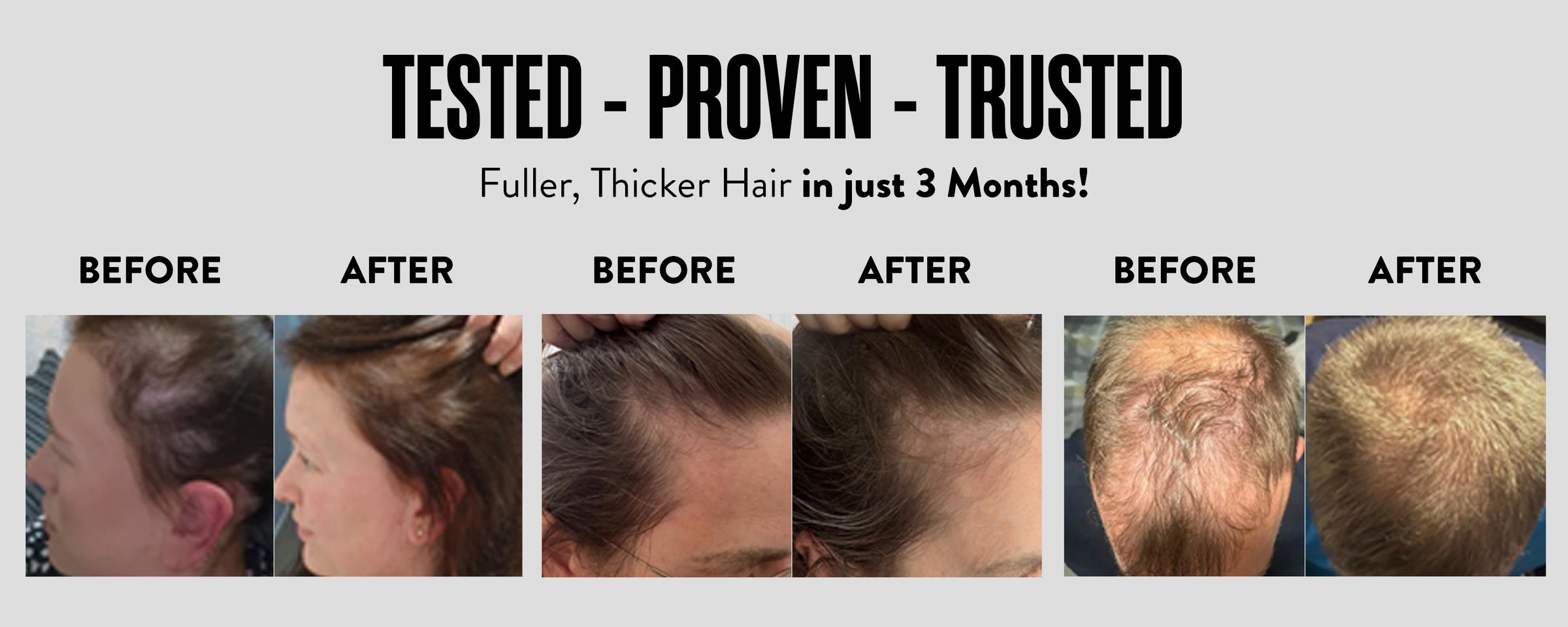 Best-selling hair-loss products.