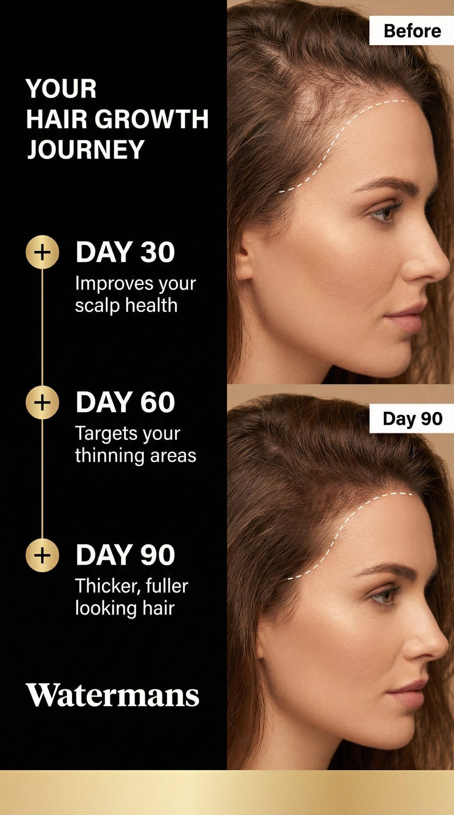 Best hair loss serum – Watermans Grow More elixir